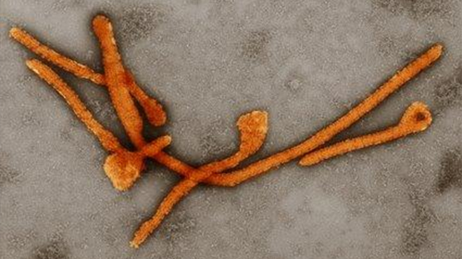 EBOV, Ebolavirus (Filoviridae), Vergrößerung 10000-fach. Zellkulturüberstand, aufgereinigt. Negativkontrastierung mit PTA. Koloriert von A. Schnartendorff