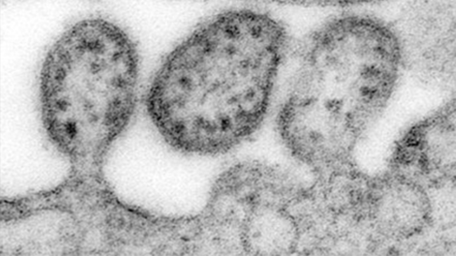 Stark vergrößerte Transmissionselektronenmikroskopie (TEM) von drei Lassa-Virus Virionen